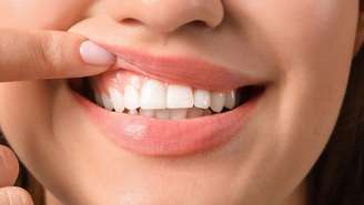 Alterações nas gengivas podem indicar problemas que vão além da boca; conheça sinais de alerta e a relação com o diabetes