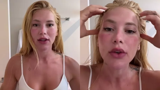 Grave? Virginia Fonseca aparece com rosto inchado e assusta seguidores