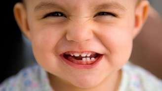 Avaliação preventiva pode identificar alterações na mordida, no crescimento facial e em hábitos que afetam a saúde bucal infantil