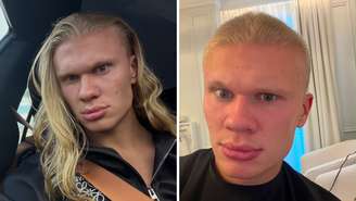Erling Haaland, conhecido pelo cabelo longo e loiro, mudou o visual e apareceu de cabeça raspada nas redes sociais