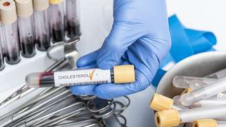 O controle é do colesterol é essencial para prevenir infarto e AVC, mas esbarra no acesso restrito aos remédios mais modernos