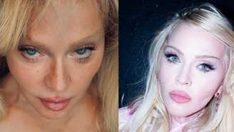 Madonna (Reprodução Redes Sociais)