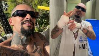 Lodk perdeu dedo no Rock in Rio (Reprodução/Instagram)