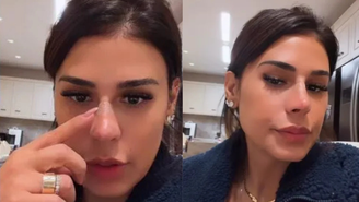 Simone Mendes revelou procedimento feito no nariz