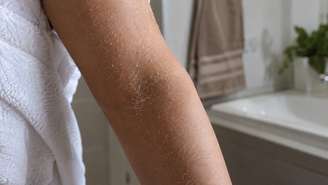 Pele levemente úmida ajuda o hidratante a reduzir perda de água
