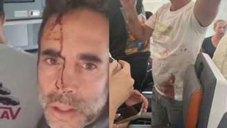 Passageiros ensanguentados após briga entre pilotos em voo da Flydubai rumo a Israel que foi desviado para a Arábia Saudita em 30 de setembro de 2026. —