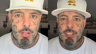 Tico Santa Cruz falou sobre seu novo tratamento com canabidiol