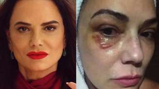 Luiza Brunet (Reprodução Redes Sociais)