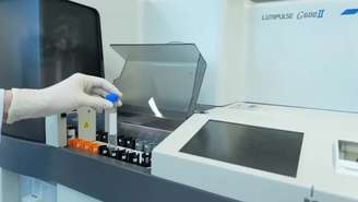 Um exame de sangue com registro na Agência Nacional de Vigilância Sanitária (Anvisa) capaz de indicar se o cérebro apresenta as marcas biológicas do Alzheimer passou a ser oferecido no Brasil a partir desta quinta