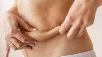 Confira cuidados com a flacidez na menopausa