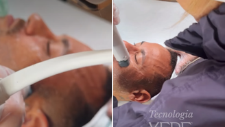 Neymar faz tratamento dermatológico com tecnologia de radiofrequência; saiba como funciona