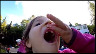 Menina exibe a "janelinha" depois de ter o dente arrancado por um drone