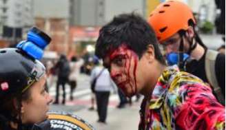 Jovem ficou ferido durante protesto contra aumento das passagens de transporte coletivo na terça-feira