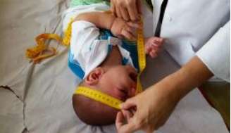 Os direitos do nascituro são garantidos pelo Código Civil, diz a Advocacia do Senado, em parecer contra o  aborto de fetos afetados pelo Zika    