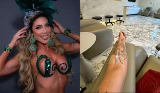 A modelo Tati Minerato, rainha de bateria e musa do Carnaval, adotou a soroterapia