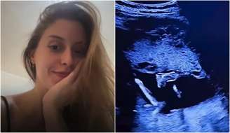 Letizia Bustos viraliza ao mostrar bebê chutando DIU