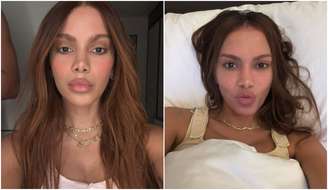 Anitta aparece com rosto diferente e gera curiosidade sobre procedimentos realizados