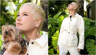 Xuxa Meneghel fez transplante capilar