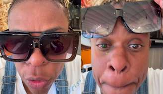 Atriz descreveu dor intensa após uso de pomada capilar