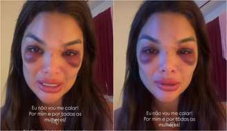 Giulia Falcão Kos desabafa sobre agressão e tentativa de feminicídio