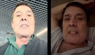 Cantor José Augusto justifica mudanças no rosto e olhar