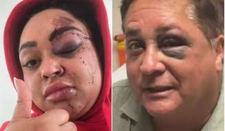 Rízia comentou a coincidência no X