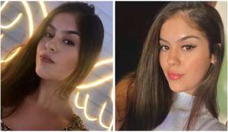 A cirurgiã-dentista Emelly de Lima e Silva, de 24 anos, morreu após sofrer um grave acidente de moto