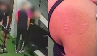 Aluna denunciou assédio após ser agarrada e mordida por instrutor em academia da Zona Norte do Recife