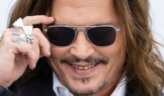 O que aconteceu com os dentes do ator Johnny Depp?.