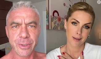 Ana Hickmann reage após acusação de fraude feita pelo ex-marido e aponta existência de 'documentos de origem duvidosa'.