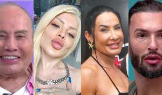 Harmonização facial de famosos: antes e depois de 20 celebridades dividem opiniões com resultados.