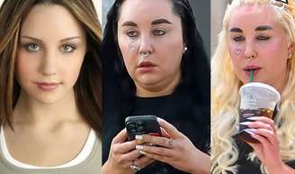 Amanda Bynes antes e depois: 20 fotos das mudanças bizarras da ex-estrela teen dos anos 2000 que está assustando os fãs.