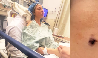 Participante de 'Casamento às Cegas' diagnosticada com câncer na gravidez quebra silêncio: 'Não tive sintomas'.