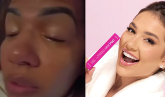 Entrevista | Vítima de produto da WePink, cabeleireira desmente versão da marca e relata momentos de tensão após passar dias sem enxergar: ‘Traumatizada’.