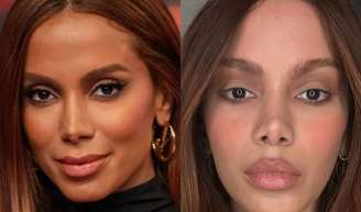 Rosto novo? Nem tudo é só bisturi! Especialista explica o que pode estar por trás da beleza renovada de Anitta, Emma Stone e mais famosas.