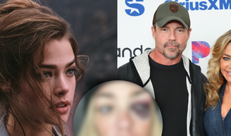 Estrela de '007', Denise Richards expõe fotos do rosto após ser espancada em episódio de paranóia do ex-marido: 'Me estrangulava'.