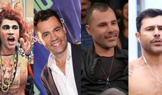 Antes e depois de Rodrigo Sant'Anna: veja como ator da 'Zorra Total' mudou com procedimentos estéticos.