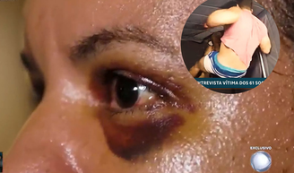 Juliana Garcia falou sobre a agressão que sofreu do então namorado, dentro do elevador de seu prédio.