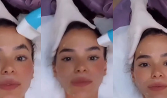 'Toda esticada e zero preenchida': hoje com 30 anos, Bruna Marquezine faz 'poupança de colágeno' com ultrassom que reduz a flacidez e ameniza rugas.