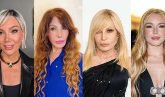 Antes e depois das famosas que apostaram em procedimentos para rejuvenescer: Elba Ramalho, Kris Jenner e mais!.