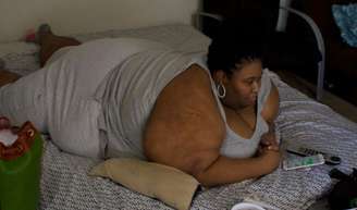 Octavia de 'Quilos Mortais' antes e depois: ela pesava 314 kg, teve recaída absurda, mas ficou irreconhecível após perder mais de 100 kg.