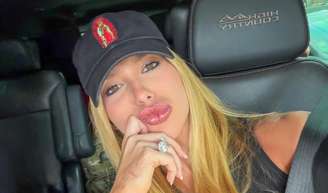 Virgínia Fonseca revela problemas de pele por ansiedade às vésperas do Carnaval: 'Toda hora que eu acho que vai melhorar...'.