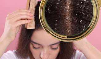 Cabelo com caspa no verão: é verdade que lavar o cabelo todo dia piora a doença? Veja o que dizem especialistas!.