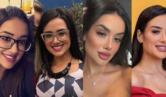 Antes e depois de Jordana, do 'BBB 26': veja como advogada mudou após gastar R$ 40 mil em procedimentos estéticos.