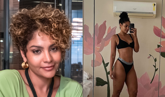 ‘Educação alimentar, equilíbrio e constância’: médica explica relação entre alimentação e lipedema, doença que afeta atriz de ‘Três Graças’ e mais 9 milhões de mulheres.