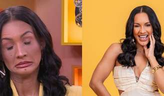 'Rosto já desinchou': fora do reencontro do 'BBB 26', Maxiane explica sumiço e estado de saúde atualizado