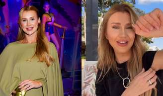 De uma só vez: Ana Paula Siebert troca de silicone, faz blefaroplastia e + 2 procedimentos em única cirurgia; médico alerta: 'Segurança sempre vem antes da estética'