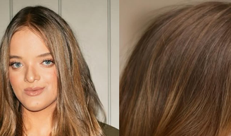 Veja antes e depois! Aos 16 anos, Rafaella Justus passa por segunda rinoplastia e ganha texto emocionado da mãe, Ticiane Pinheiro: ‘Reconhecer o que a incomodava’.