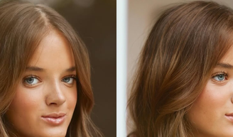 Rafaella Justus fez rinoplastia com retirada de cartilagem da costela; médico explica método: ‘Enxertos para modelar o nariz’.