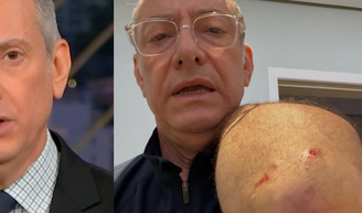 Âncora da Globo, José Roberto Burnier leva 4 pontos após ataque de pitbull sem guia: ‘O preço da irresponsabilidade’.